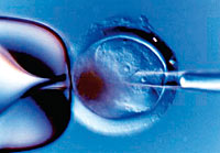 Instruktion »Dignitas personae« über einige Fragen der Bioethik Instruktion »Dignitas personae« über einige Fragen der Bioethik